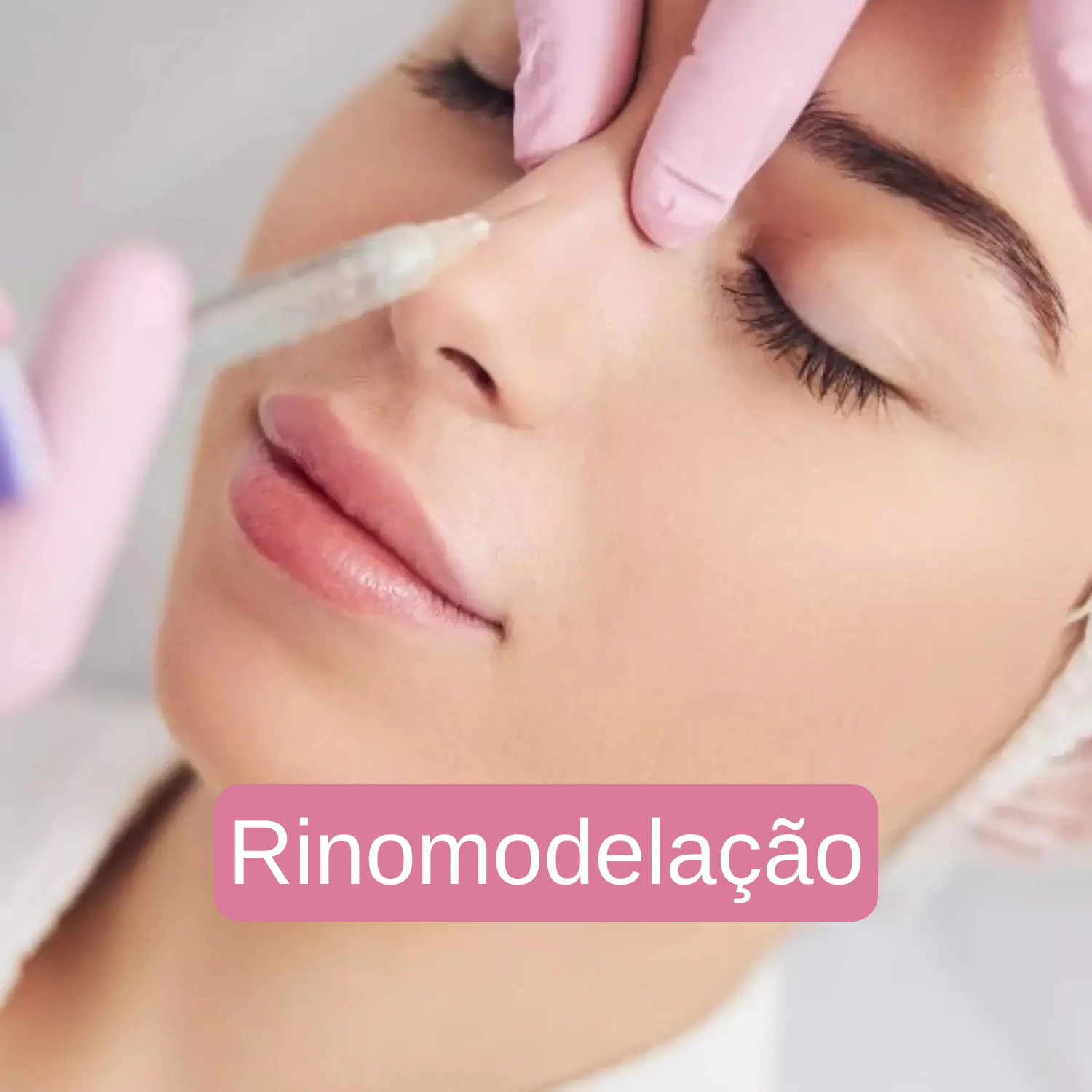 BOTOX (1)Resultado